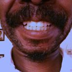 Derrick
